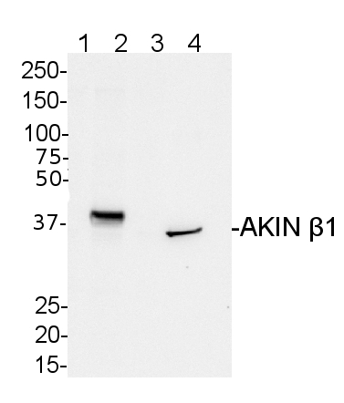 western blot detection using anti-AKIN beta-1 antibodies